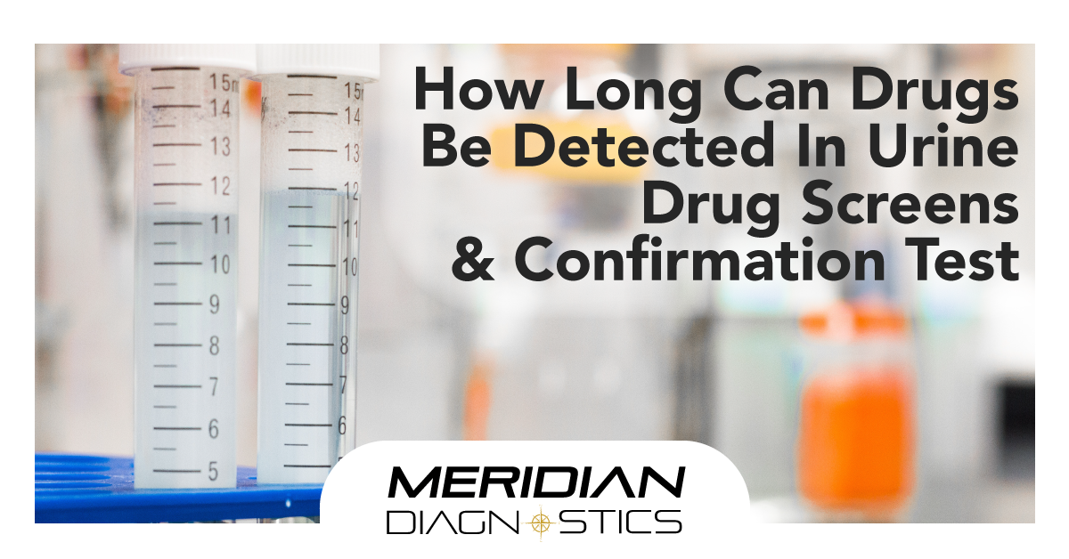 Drug Detection Windows in Urine