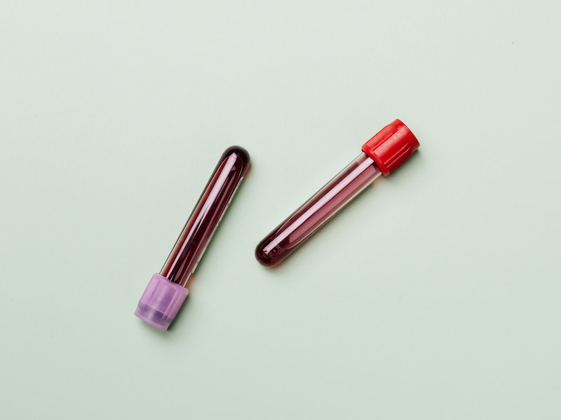 How to read blood test results