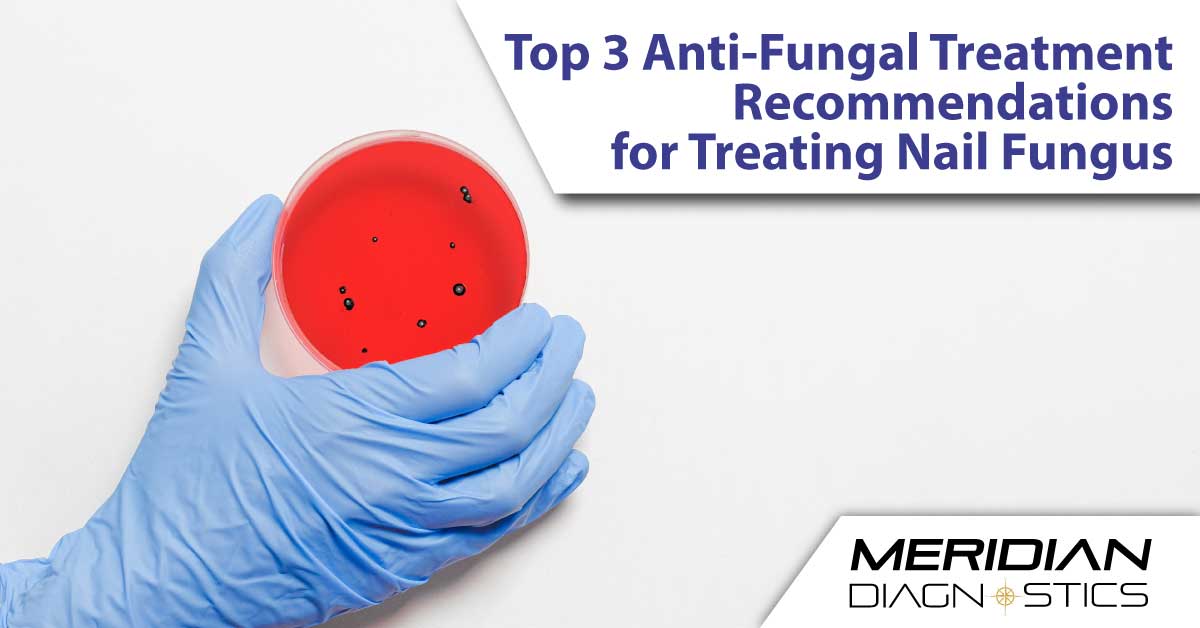 Top 3 Antifungal Treatment